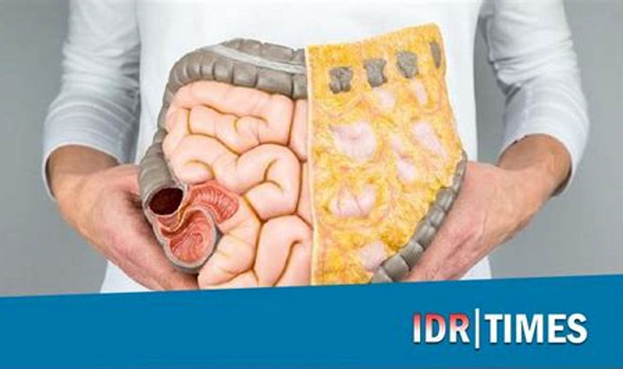 Cara Mengatasi Usus Kotor Cara Mengatasi Usus Kotor